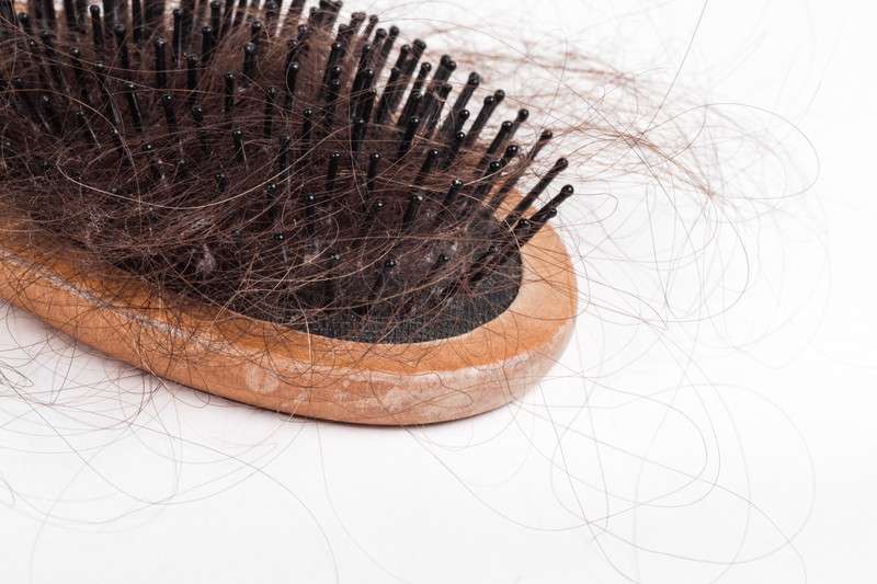 抜け毛の原因と対策について
